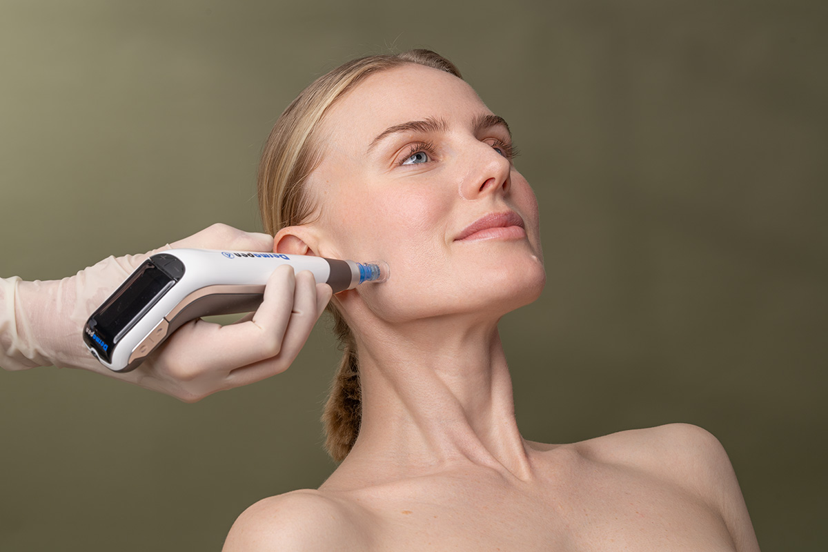 Dermapen-Behandlung-Zürich-Hautatelier